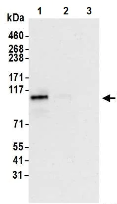 Immunoprecipitation - Anti-HIF-2-alpha antibody [BL-95-1A2] - BSA free (AB272041)