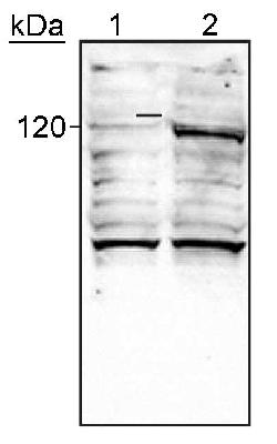 Western blot - Anti-HIF-2-alpha antibody [ep190b] (AB8365)