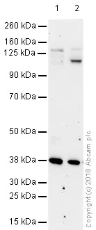 Western blot - Anti-HIF-2-alpha antibody [ep190b] (AB8365)