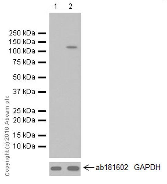 Western blot - Anti-HIF-2-alpha antibody [EPR19656] (AB207607)