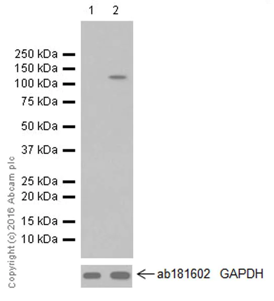 Western blot - Anti-HIF-2-alpha antibody [EPR19656] (AB207607)
