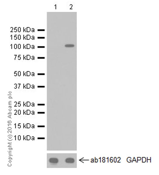 Western blot - Anti-HIF-2-alpha antibody [EPR19656] (AB207607)