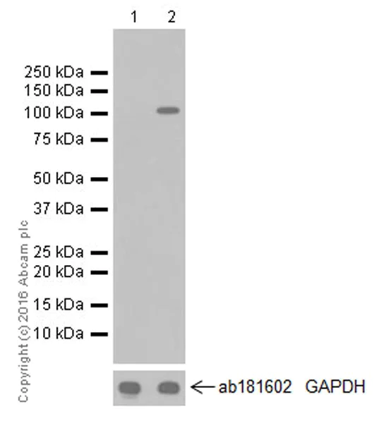 Anti-HIF-2-alpha antibody [EPR19656] Rabbit monoclonal (ab207607