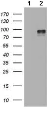Western blot - Anti-HIF-2-alpha antibody [OTI2G5] (AB157249)