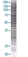 SDS-PAGE - HIF-2-alpha overexpression 293T lysate (whole cell) (AB94045), expandable thumbnail