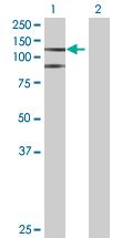Western blot - HIF-2-alpha overexpression 293T lysate (whole cell) (AB94045), expandable thumbnail
