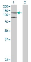 Western blot - HIF-2-alpha overexpression 293T lysate (whole cell) (AB94045)