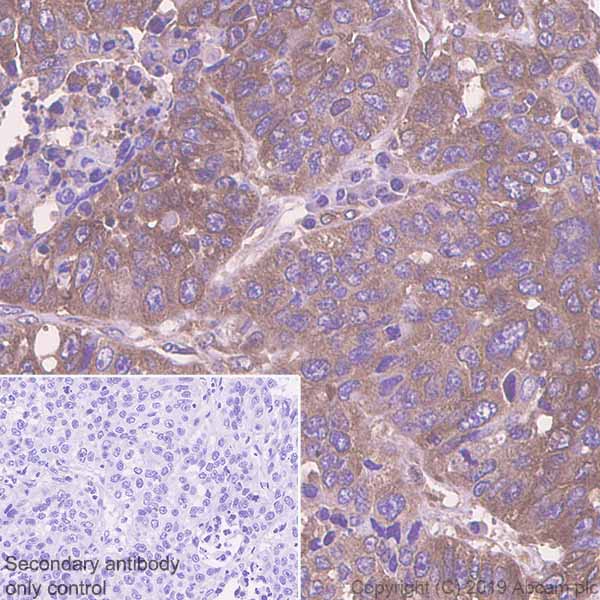 Immunohistochemistry (Formalin/PFA-fixed paraffin-embedded sections) - Anti-HIF Prolyl Hydroxylases antibody [EPR3664(2)-25] - BSA and Azide free (AB256316), expandable thumbnail