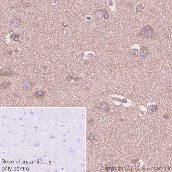Immunohistochemistry (Formalin/PFA-fixed paraffin-embedded sections) - Anti-HIF Prolyl Hydroxylases antibody [EPR3664(2)-25] - BSA and Azide free (AB256316), expandable thumbnail