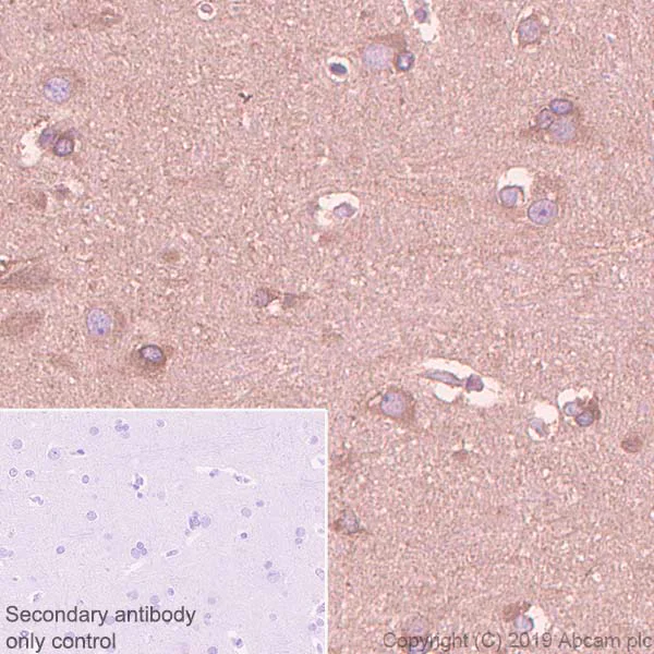 Immunohistochemistry (Formalin/PFA-fixed paraffin-embedded sections) - Anti-HIF Prolyl Hydroxylases antibody [EPR3664(2)-25] - BSA and Azide free (AB256316)