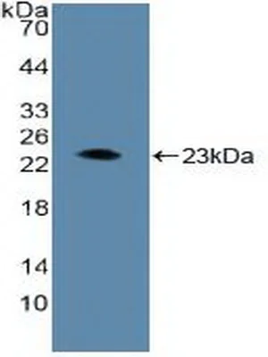 Western blot - Anti-HIF1 beta antibody (AB232964)