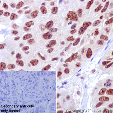 Immunohistochemistry (Formalin/PFA-fixed paraffin-embedded sections) - Anti-HIF1 beta antibody [EPR17516] (AB184711)