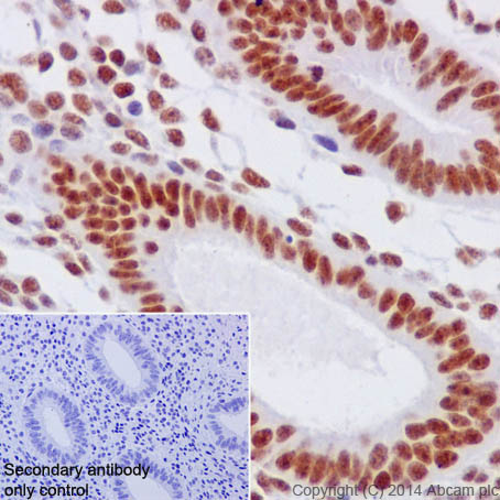 Immunohistochemistry (Formalin/PFA-fixed paraffin-embedded sections) - Anti-HIF1 beta antibody [EPR17516] (AB184711), expandable thumbnail