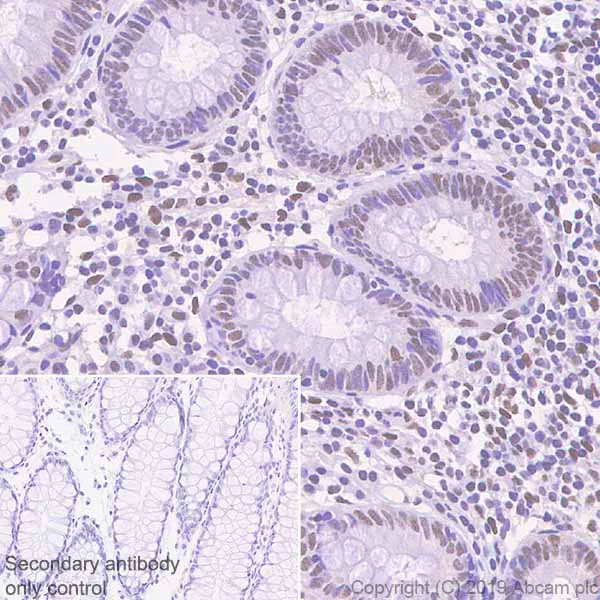Immunohistochemistry (Formalin/PFA-fixed paraffin-embedded sections) - Anti-HIF1 beta antibody [EPR23106-151] (AB270520)
