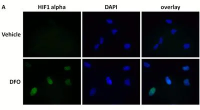 Immunocytochemistry/ Immunofluorescence - HIF1a + GLUT1 Hypoxia Response Human Flow Cytometry Kit (AB126584)