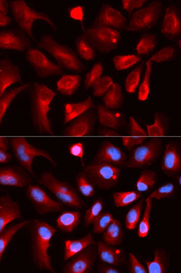 Immunocytochemistry/ Immunofluorescence - Anti-HIF1AN/FIH-1 antibody (AB187524)