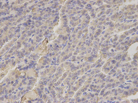 Immunohistochemistry (Formalin/PFA-fixed paraffin-embedded sections) - Anti-HIF1AN/FIH-1 antibody (AB187524)