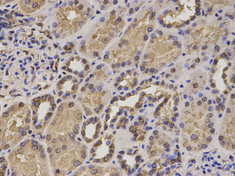 Immunohistochemistry (Formalin/PFA-fixed paraffin-embedded sections) - Anti-HIF1AN/FIH-1 antibody (AB187524)