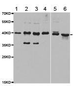 Western blot - Anti-HIF1AN/FIH-1 antibody (AB187524)