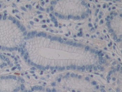 Immunohistochemistry (Formalin/PFA-fixed paraffin-embedded sections) - Anti-HIF1AN/FIH-1 antibody (AB233141)