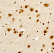 Immunohistochemistry (Formalin/PFA-fixed paraffin-embedded sections) - Anti-HIF1AN/FIH-1 antibody [EPR3658] (AB92498)