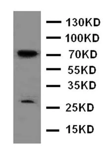 Western blot - Anti-HIF3 alpha/IPAS antibody (AB176464)