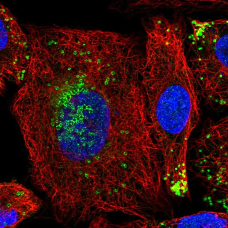 Immunocytochemistry/ Immunofluorescence - Anti-HIG2 antibody (AB252976)