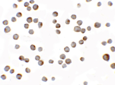 Immunocytochemistry - Anti-HIGD1A antibody (AB117456)