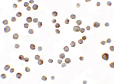 Immunocytochemistry - Anti-HIGD1A antibody (AB117456)
