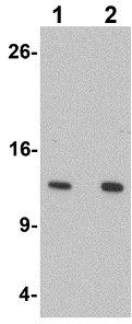 Western blot - Anti-HIGD1A antibody (AB117456)