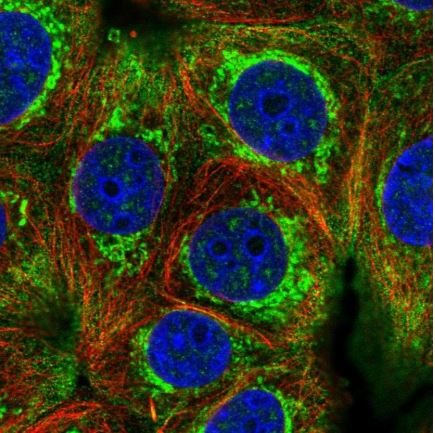 Immunocytochemistry/ Immunofluorescence - Anti-HIGD2A antibody (AB150893), expandable thumbnail