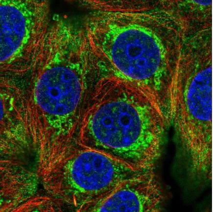 Immunocytochemistry/ Immunofluorescence - Anti-HIGD2A antibody (AB150893)