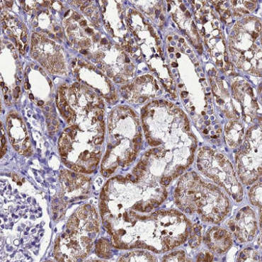 Immunohistochemistry (Formalin/PFA-fixed paraffin-embedded sections) - Anti-HIGD2A antibody (AB150893), expandable thumbnail