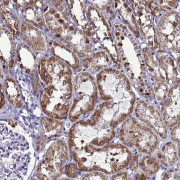 Immunohistochemistry (Formalin/PFA-fixed paraffin-embedded sections) - Anti-HIGD2A antibody (AB150893)
