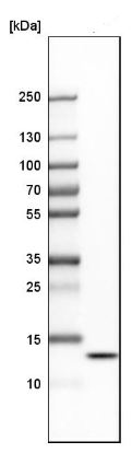 Western blot - Anti-HIGD2A antibody (AB150893), expandable thumbnail