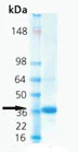 SDS-PAGE - High activity fusion construct of human soluble TRAP/CD40L (AB168061)
