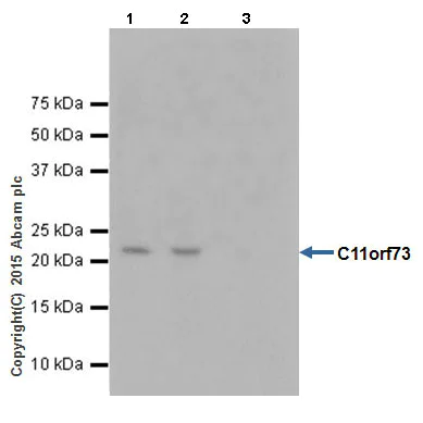 Immunoprecipitation - Anti-HIKESHI antibody [EPR17761] - BSA and Azide free (AB251362)