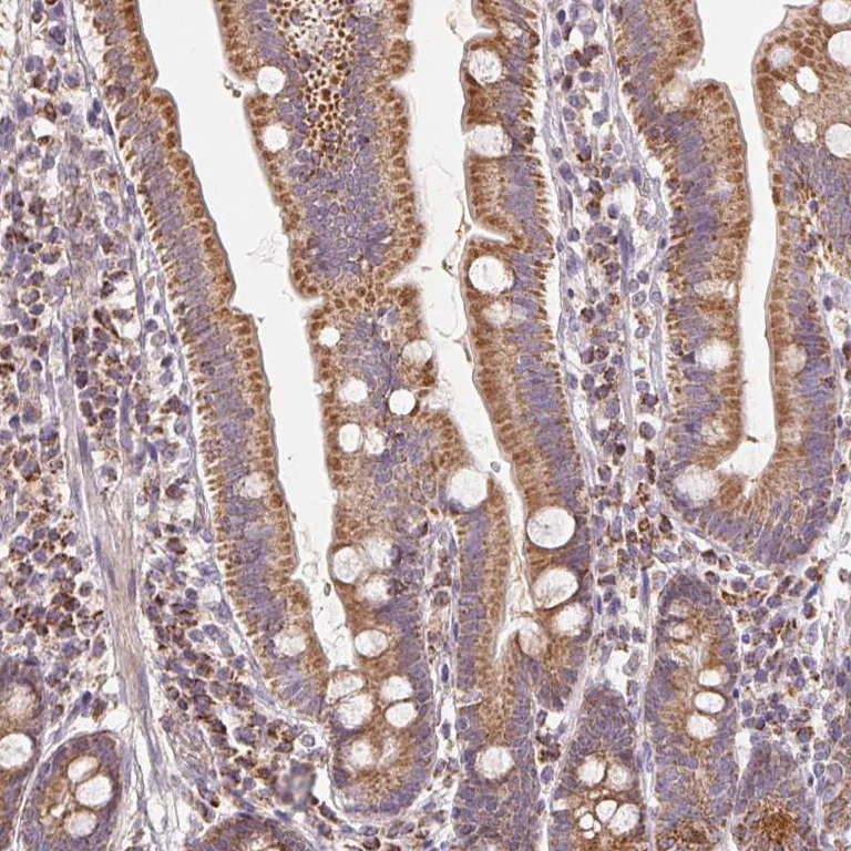 Immunohistochemistry (Formalin/PFA-fixed paraffin-embedded sections) - Anti-HINT2 antibody (AB220935)