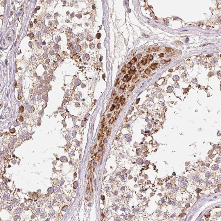 Immunohistochemistry (Formalin/PFA-fixed paraffin-embedded sections) - Anti-HINT2 antibody (AB220935)