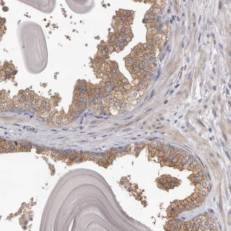 Immunohistochemistry (Formalin/PFA-fixed paraffin-embedded sections) - Anti-HINT3 antibody (AB121960)