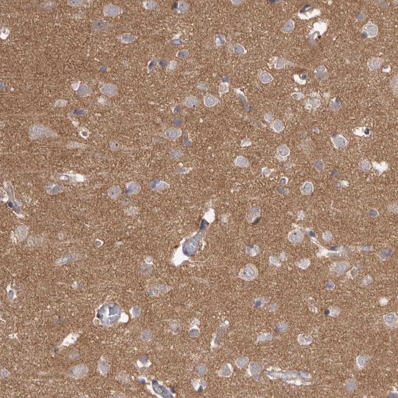 Immunohistochemistry (Formalin/PFA-fixed paraffin-embedded sections) - Anti-HINT3 antibody (AB121960)