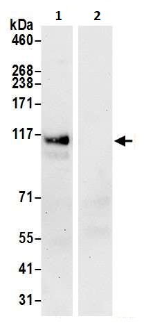 Immunoprecipitation - Anti-HIP1 antibody (AB264376)