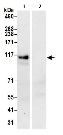 Immunoprecipitation - Anti-HIP1 antibody (AB264376)