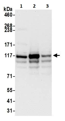 Western blot - Anti-HIP1 antibody (AB264376)