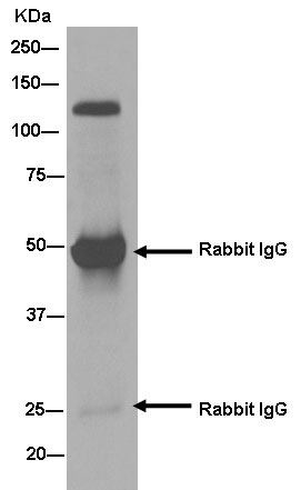Immunoprecipitation - Anti-HIP1 antibody [EPR10814] - BSA and Azide free (AB250453), expandable thumbnail