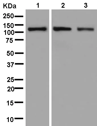 Western blot - Anti-HIP1 antibody [EPR10814] - BSA and Azide free (AB250453)
