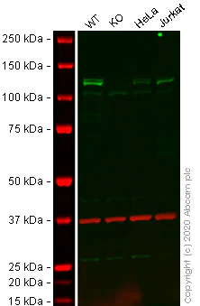 Western blot - Anti-HIP1 antibody [EPR10814] - BSA and Azide free (AB250453)