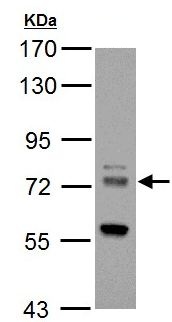 Western blot - Anti-HIP14 antibody (AB154054), expandable thumbnail
