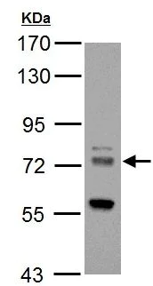 Western blot - Anti-HIP14 antibody (AB154054)