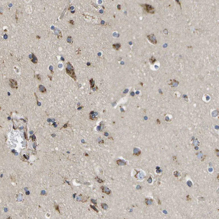 Immunohistochemistry (Formalin/PFA-fixed paraffin-embedded sections) - Anti-HIP14 antibody (AB253017)